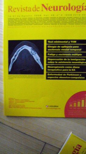 Portada del libro de REVISTA DE NEUROLOGÍA Vol. 49 Núm. 4